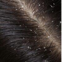 NURME - Hair Care dovanų rinkinys For Irritated Scalp